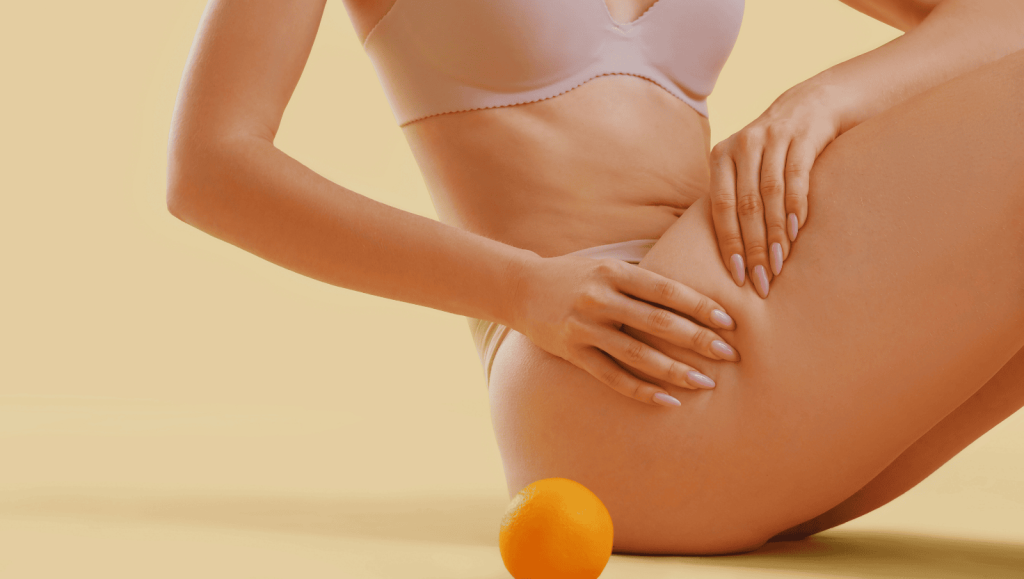 Cellulite